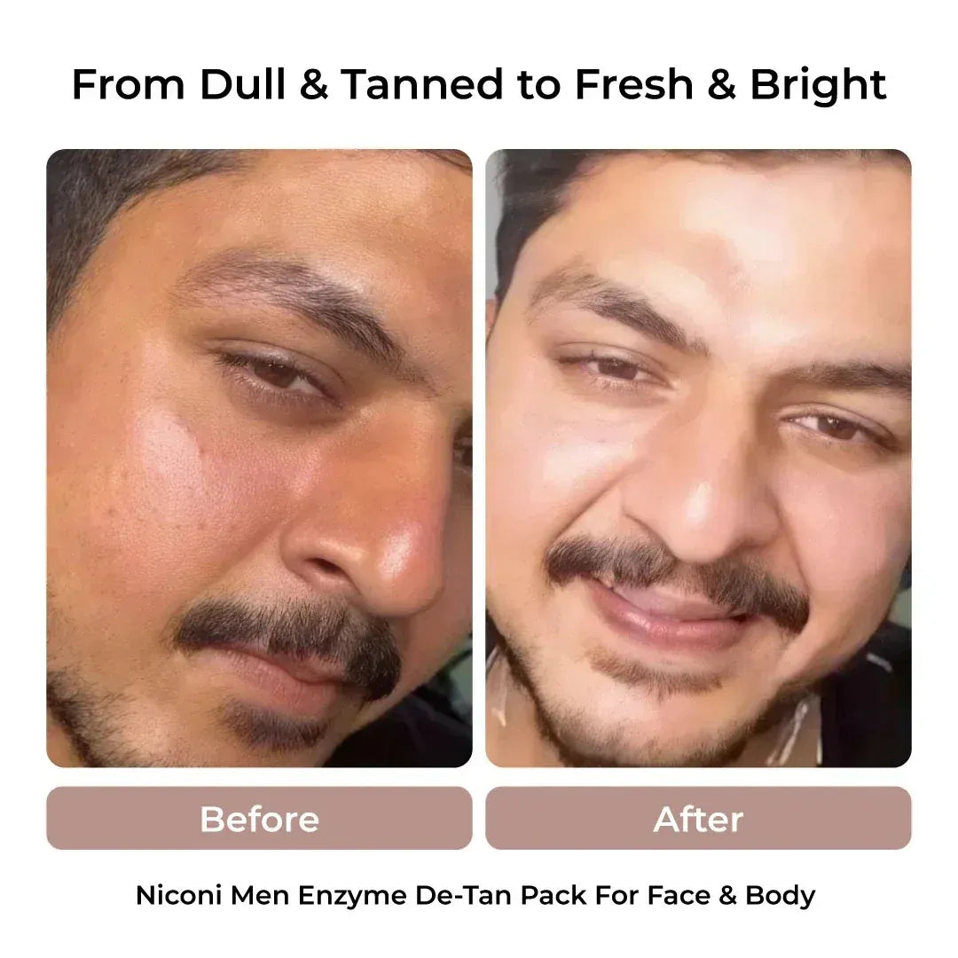 Men's Enzyme De- Tan Face Pack